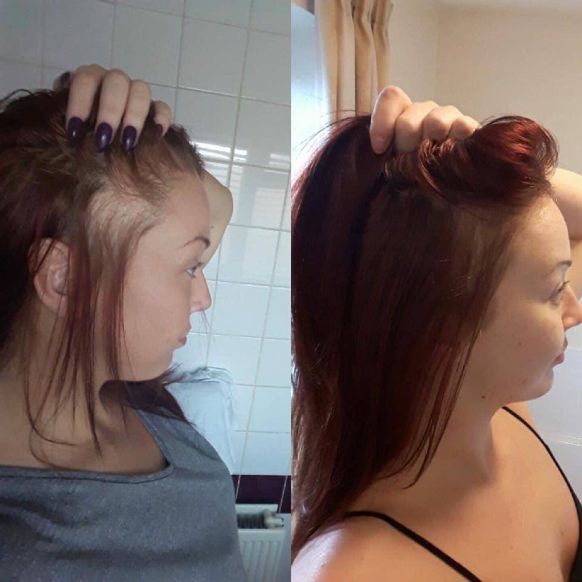 Erfahrungsbericht: Haar Vorher-Nachher